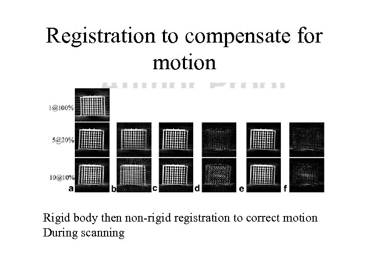 Registration to compensate for motion Rigid body then non-rigid registration to correct motion During