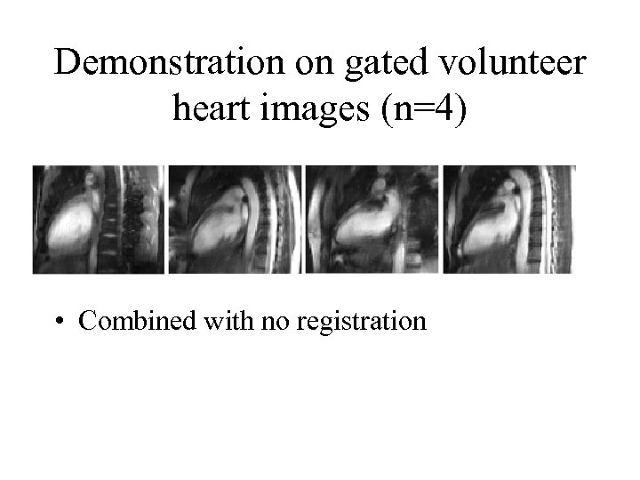 Demonstration on gated volunteer heart images (n=4) • Combined with no registration 