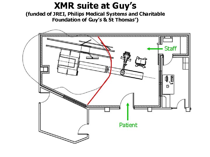 XMR suite at Guy’s (funded of JREI, Philips Medical Systems and Charitable Foundation of