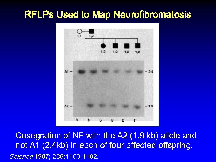  RFLPs Used to Map Neurofibromatosis Cosegration of NF with the A 2 (1.