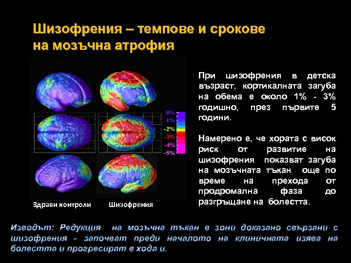 Шизофрения – темпове и срокове на мозъчна атрофия При шизофрения в детска възраст, кортикалната