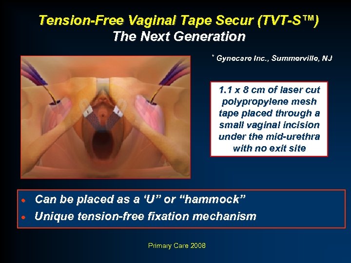 Tension-Free Vaginal Tape Secur (TVT-S™) The Next Generation * Gynecare Inc. , Summerville, NJ