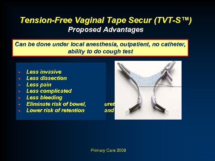 Tension-Free Vaginal Tape Secur (TVT-S™) Proposed Advantages Can be done under local anesthesia, outpatient,