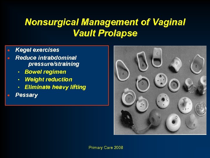 Nonsurgical Management of Vaginal Vault Prolapse Kegel exercises · Reduce intrabdominal pressure/straining • Bowel