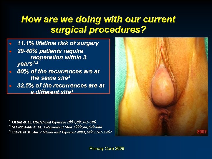 How are we doing with our current surgical procedures? · · 11. 1% lifetime