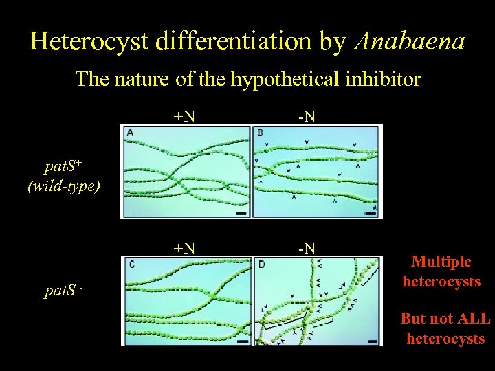 Heterocyst differentiation by Anabaena The nature of the hypothetical inhibitor +N -N pat. S+