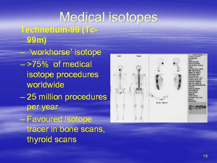 Medical isotopes Technetium-99 (Tc 99 m) – ‘workhorse’ isotope – >75% of medical isotope