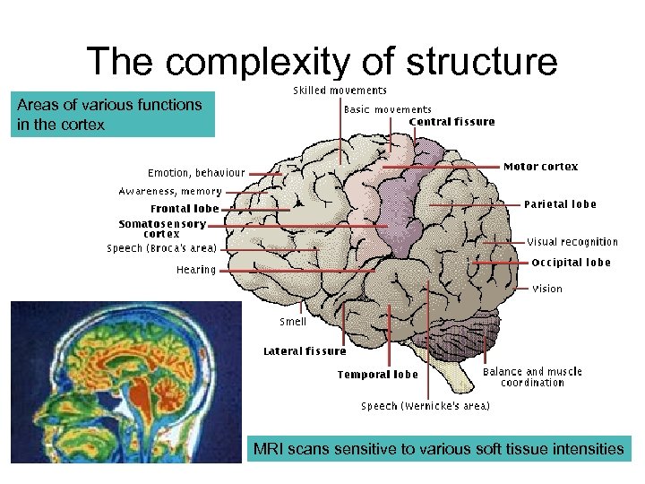 The complexity of structure Areas of various functions in the cortex MRI scans sensitive