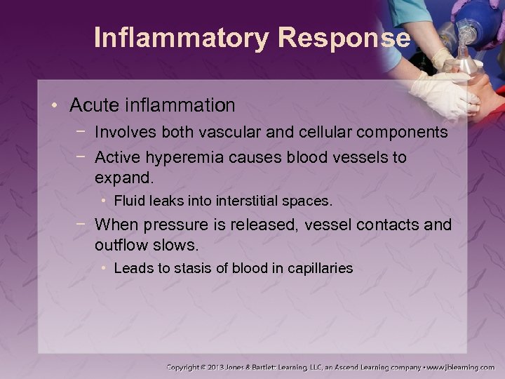 Inflammatory Response • Acute inflammation − Involves both vascular and cellular components − Active