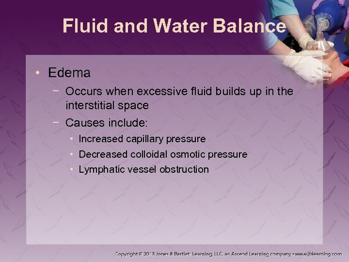Fluid and Water Balance • Edema − Occurs when excessive fluid builds up in