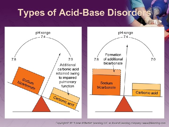 Types of Acid-Base Disorders 