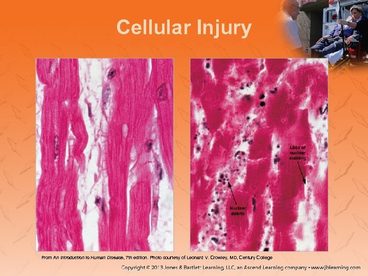 Cellular Injury From An Introduction to Human Disease, 7 th edition. Photo courtesy of