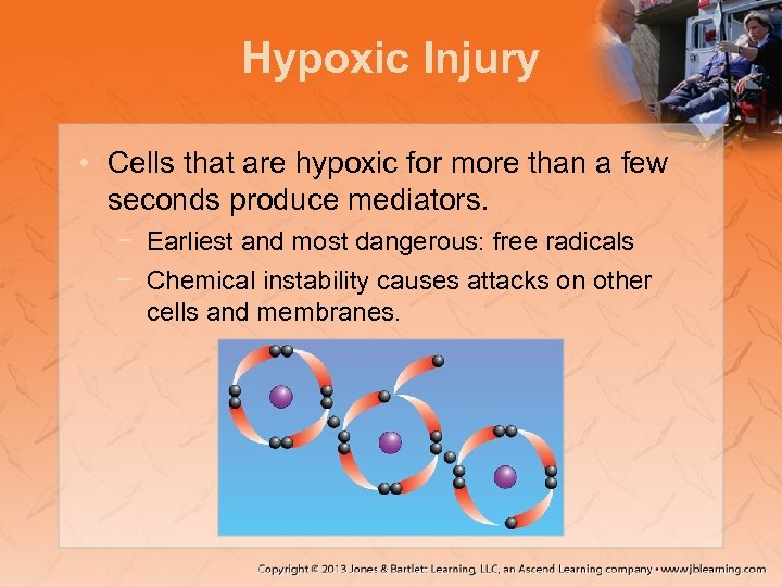 Hypoxic Injury • Cells that are hypoxic for more than a few seconds produce