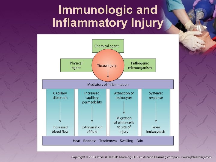 Immunologic and Inflammatory Injury 