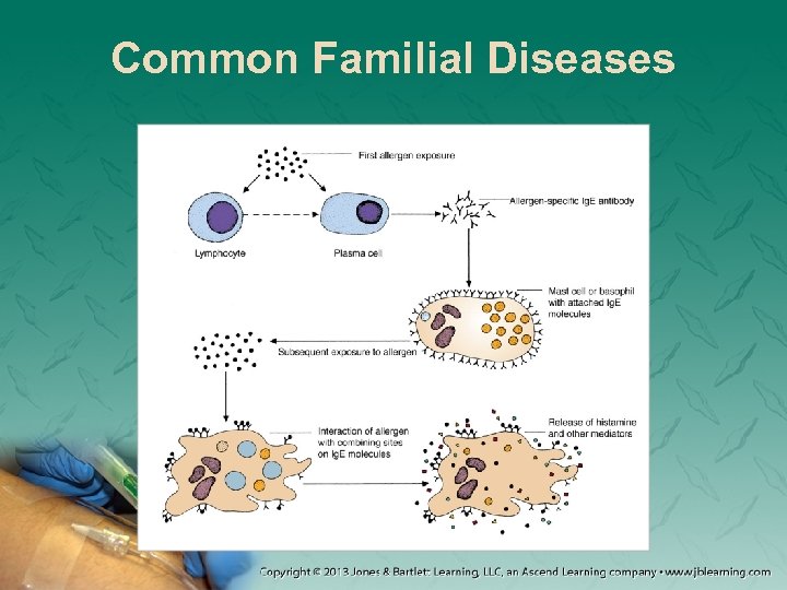 Common Familial Diseases 