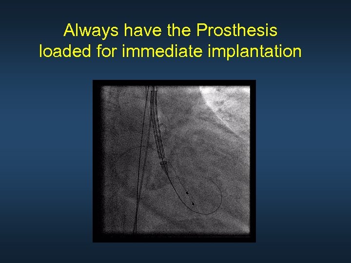 Always have the Prosthesis loaded for immediate implantation 