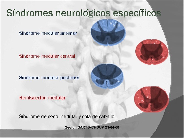 Síndrome medular anterior Síndrome medular central Síndrome medular posterior Hemisección medular Síndrome de cono