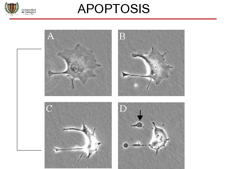 APOPTOSIS 