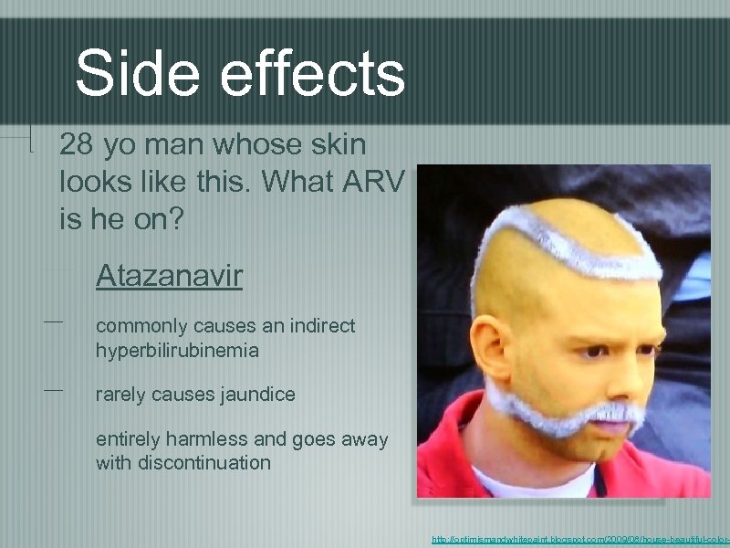 Side effects 28 yo man whose skin looks like this. What ARV is he