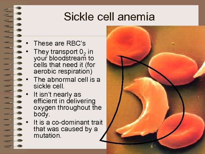 Sickle cell anemia • These are RBC’s • They transport 02 in your bloodstream