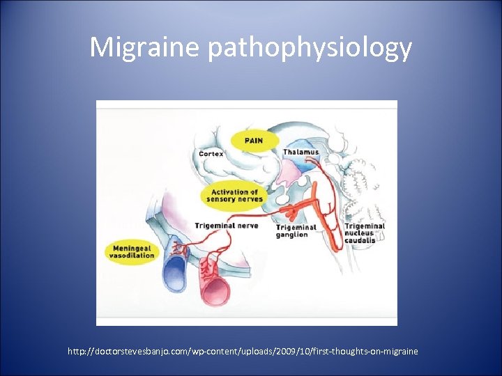 Migraine pathophysiology http: //doctorstevesbanjo. com/wp-content/uploads/2009/10/first-thoughts-on-migraine 