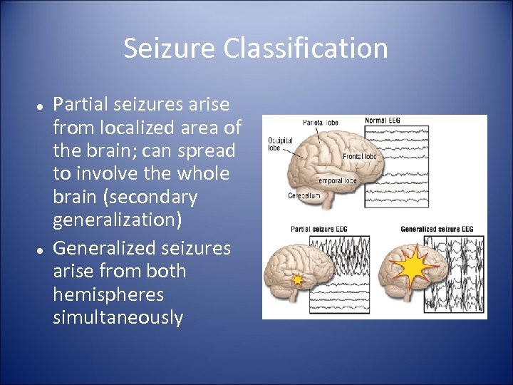Seizure Classification Partial seizures arise from localized area of the brain; can spread to