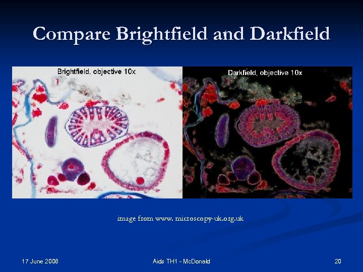 Compare Brightfield and Darkfield image from www. microscopy-uk. org. uk 17 June 2006 Aids