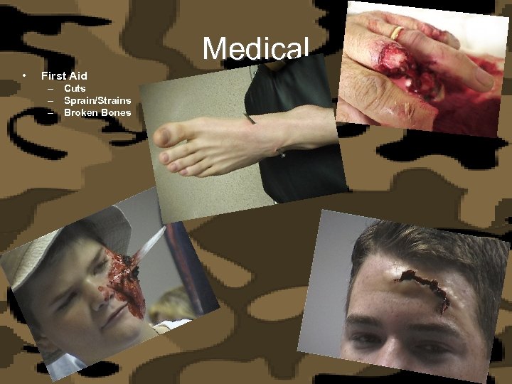 Medical • First Aid – Cuts – Sprain/Strains – Broken Bones 