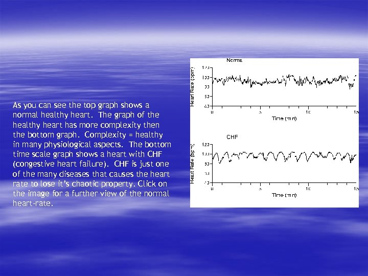 As you can see the top graph shows a normal healthy heart. The graph