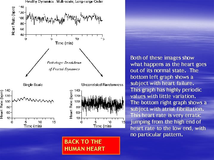Both of these images show what happens as the heart goes out of its