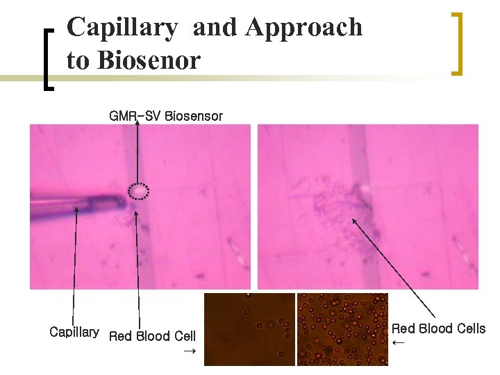 Capillary and Approach to Biosenor GMR-SV Biosensor Capillary Red Blood Cell → Red Blood