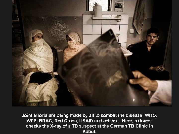 Joint efforts are being made by all to combat the disease: WHO, WFP, BRAC,