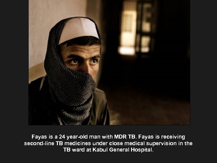 Fayas is a 24 year-old man with MDR TB. Fayas is receiving second-line TB