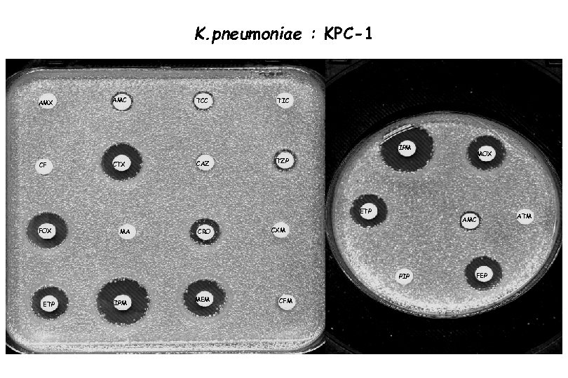 K. pneumoniae : KPC-1 AMX AMC TCC TIC IPM CF CTX CAZ ETP FOX