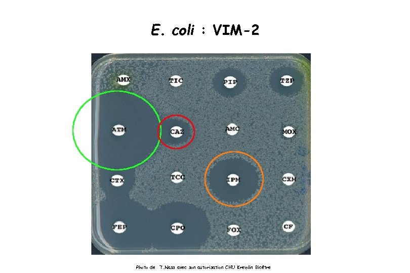 E. coli : VIM-2 Photo de T. Nass avec son autorisation CHU Kremlin Bicêtre