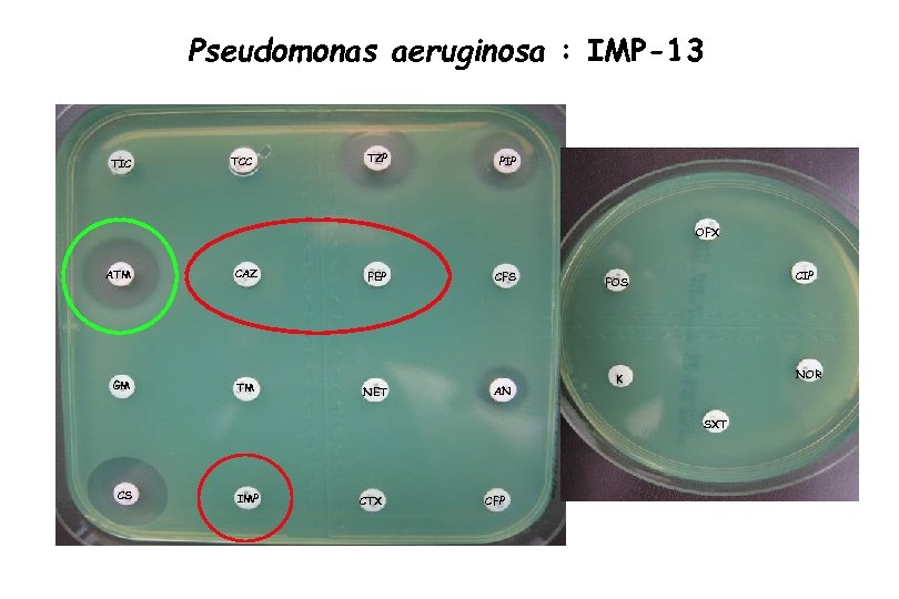 Pseudomonas aeruginosa : IMP-13 TIC TCC TZP PIP OFX ATM CAZ GM TM FEP