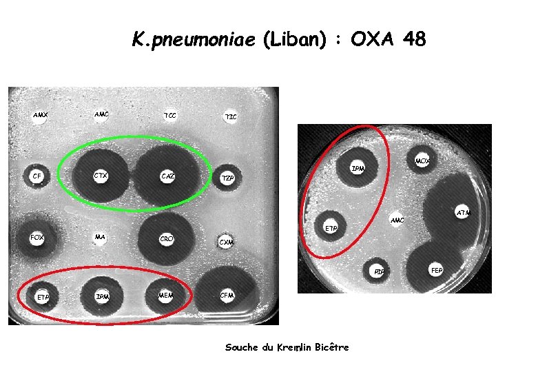 K. pneumoniae (Liban) : OXA 48 AMX CF FOX AMC CTX MA TCC CAZ