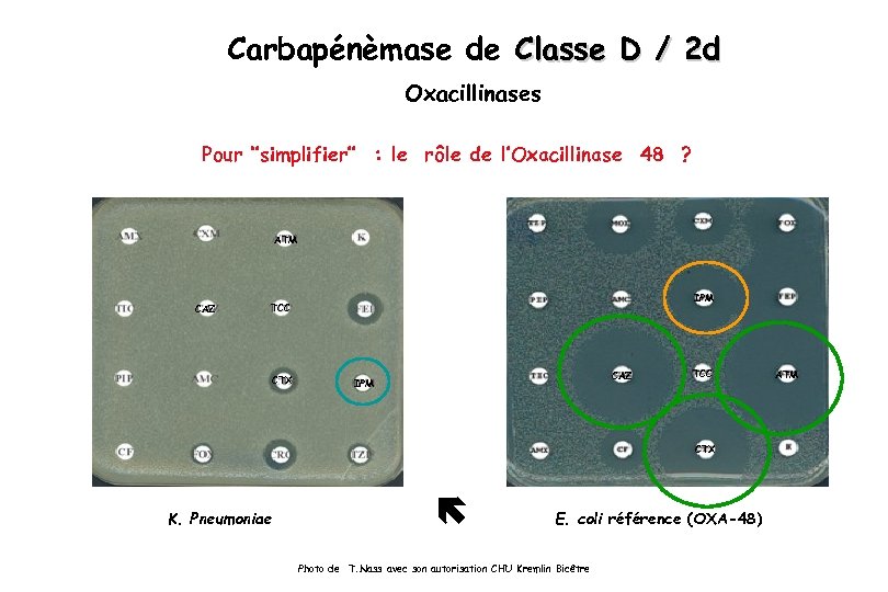 Carbapénèmase de Classe D / 2 d Oxacillinases Pour ‘’simplifier’’ : le rôle de