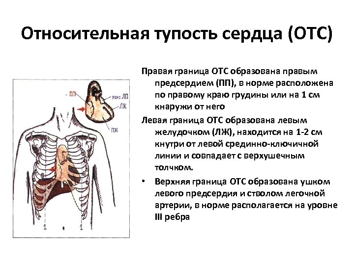 Относительная тупость сердца (ОТС) Правая граница ОТС образована правым предсердием (ПП), в норме расположена