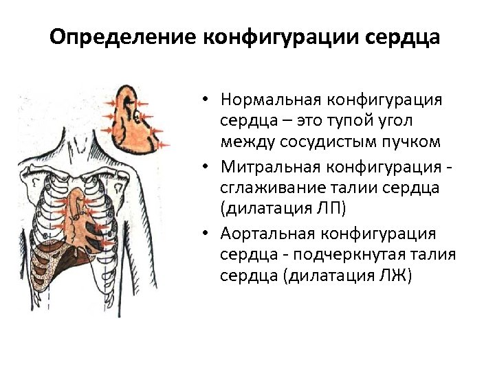 Определение конфигурации сердца • Нормальная конфигурация сердца – это тупой угол между сосудистым пучком