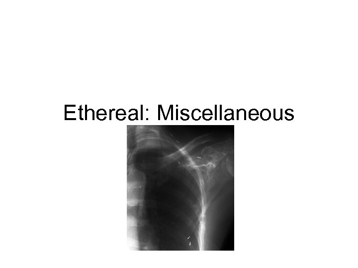 Ethereal: Miscellaneous 