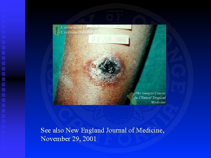 See also New England Journal of Medicine, November 29, 2001 