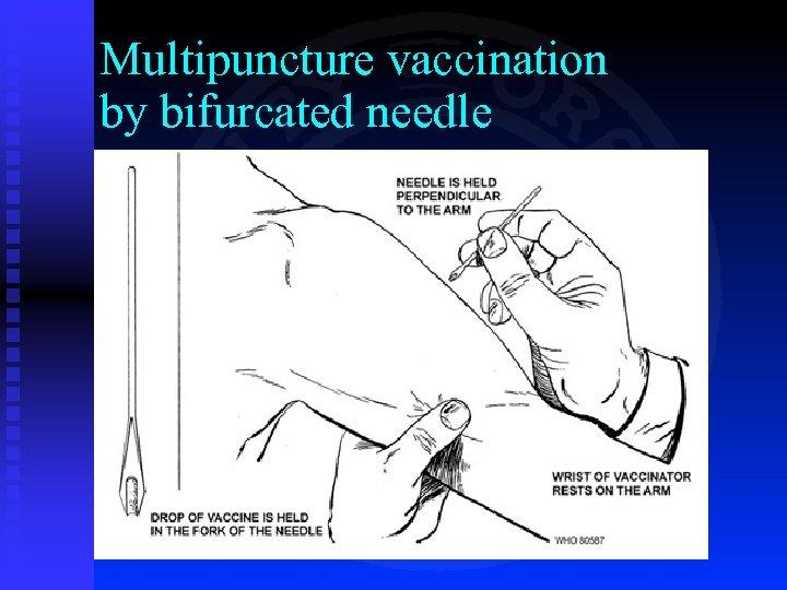 Multipuncture vaccination by bifurcated needle 