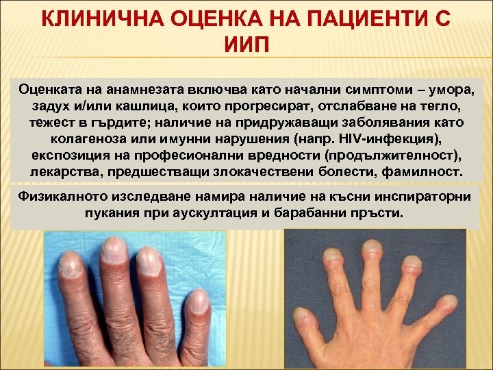 КЛИНИЧНА ОЦЕНКА НА ПАЦИЕНТИ С ИИП Оценката на анамнезата включва като начални симптоми –