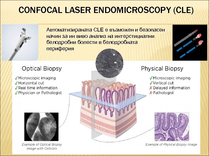 CONFOCAL LASER ENDOMICROSCOPY (CLE) Автоматизираната CLE е възможен и безопасен начин за ин виво
