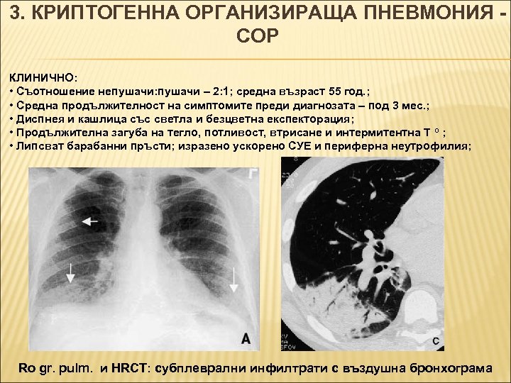 3. КРИПТОГЕННА ОРГАНИЗИРАЩА ПНЕВМОНИЯ COP КЛИНИЧНО: • Съотношение непушачи: пушачи – 2: 1; средна