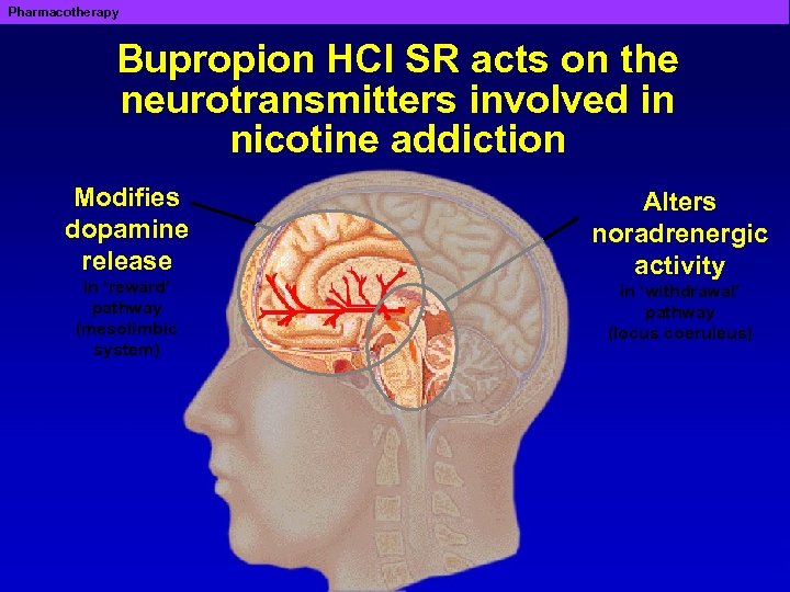 Pharmacotherapy Bupropion HCl SR acts on the neurotransmitters involved in nicotine addiction Modifies dopamine