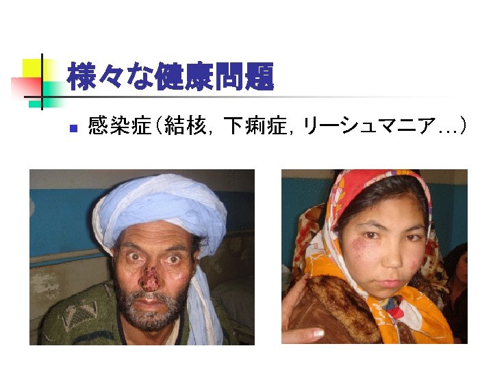 様々な健康問題 n 感染症（結核，下痢症，リーシュマニア…） 