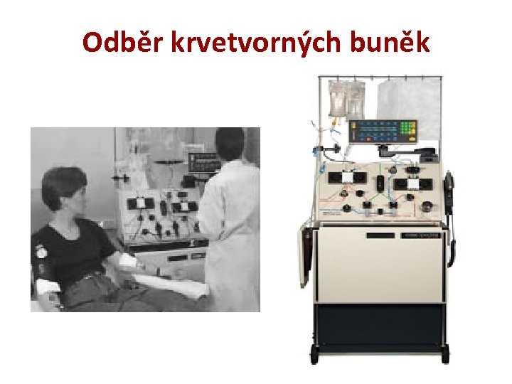 Odběr krvetvorných buněk 