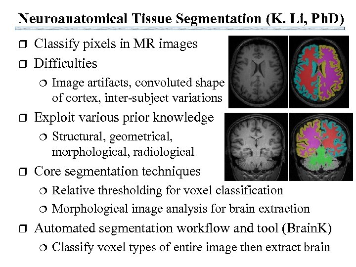 Neuroanatomical Tissue Segmentation (K. Li, Ph. D) r r Classify pixels in MR images
